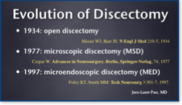 Evolution of diskectomy
