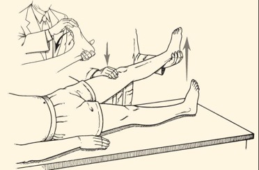 椎間盤突出的理學檢查